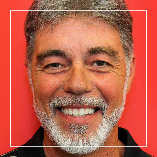 Cosmetic dentistry patient of Dr. Green in Springfield, MO