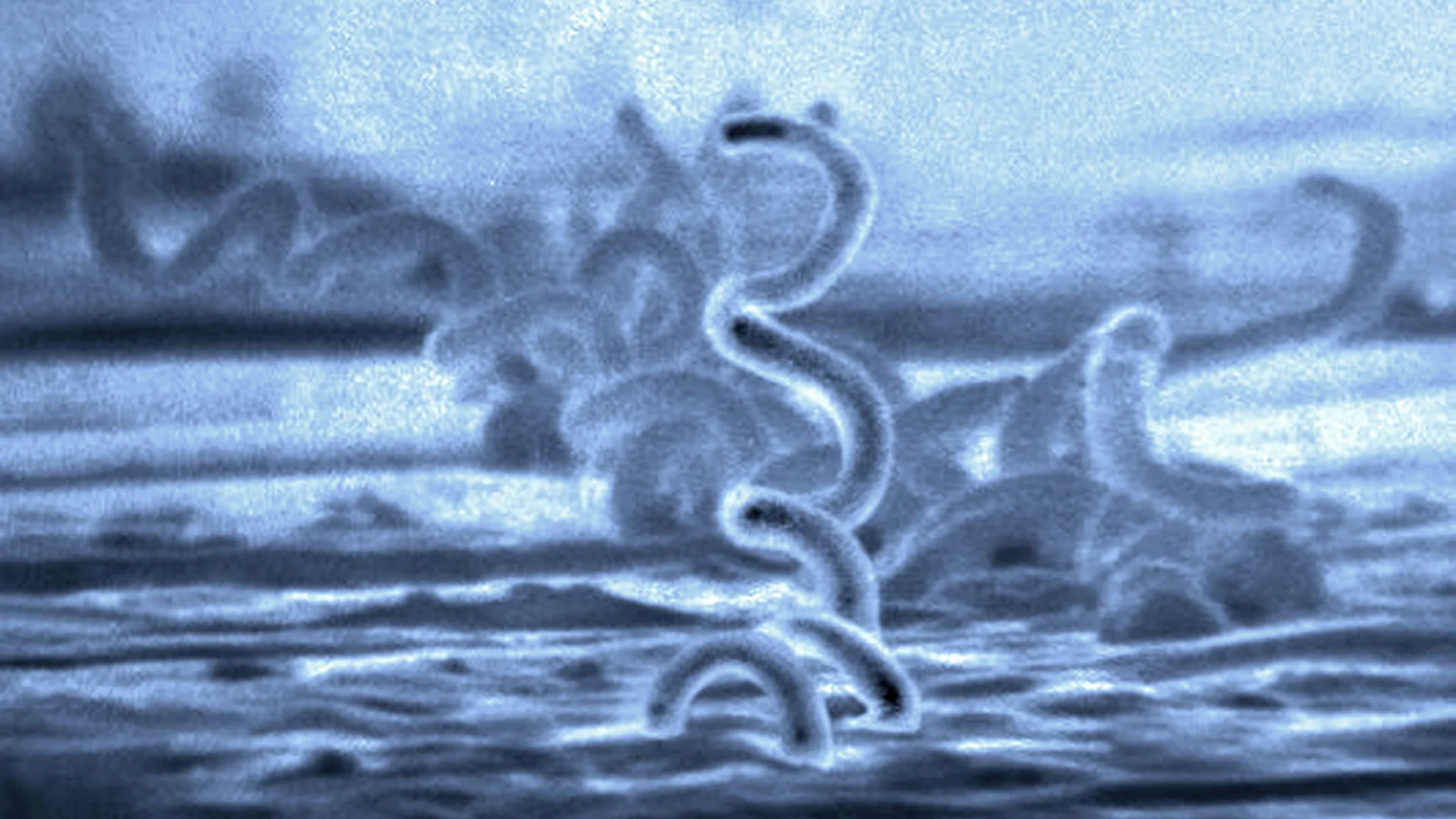 A microbe similar to this syphilis spirochete is the cause of Lyme disease. From UNDER OUR SKIN, a film by Andy Abrahams Wilson.