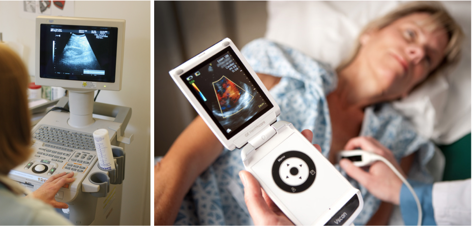 A traditional non-portable ultrasound machine (left) next to the new portable $7,900 GE Vscan device (right) 