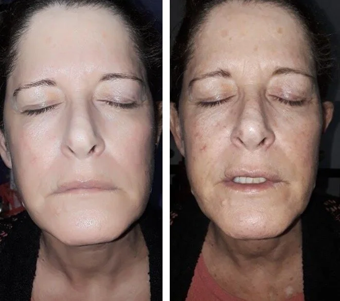 We have a magic laser!