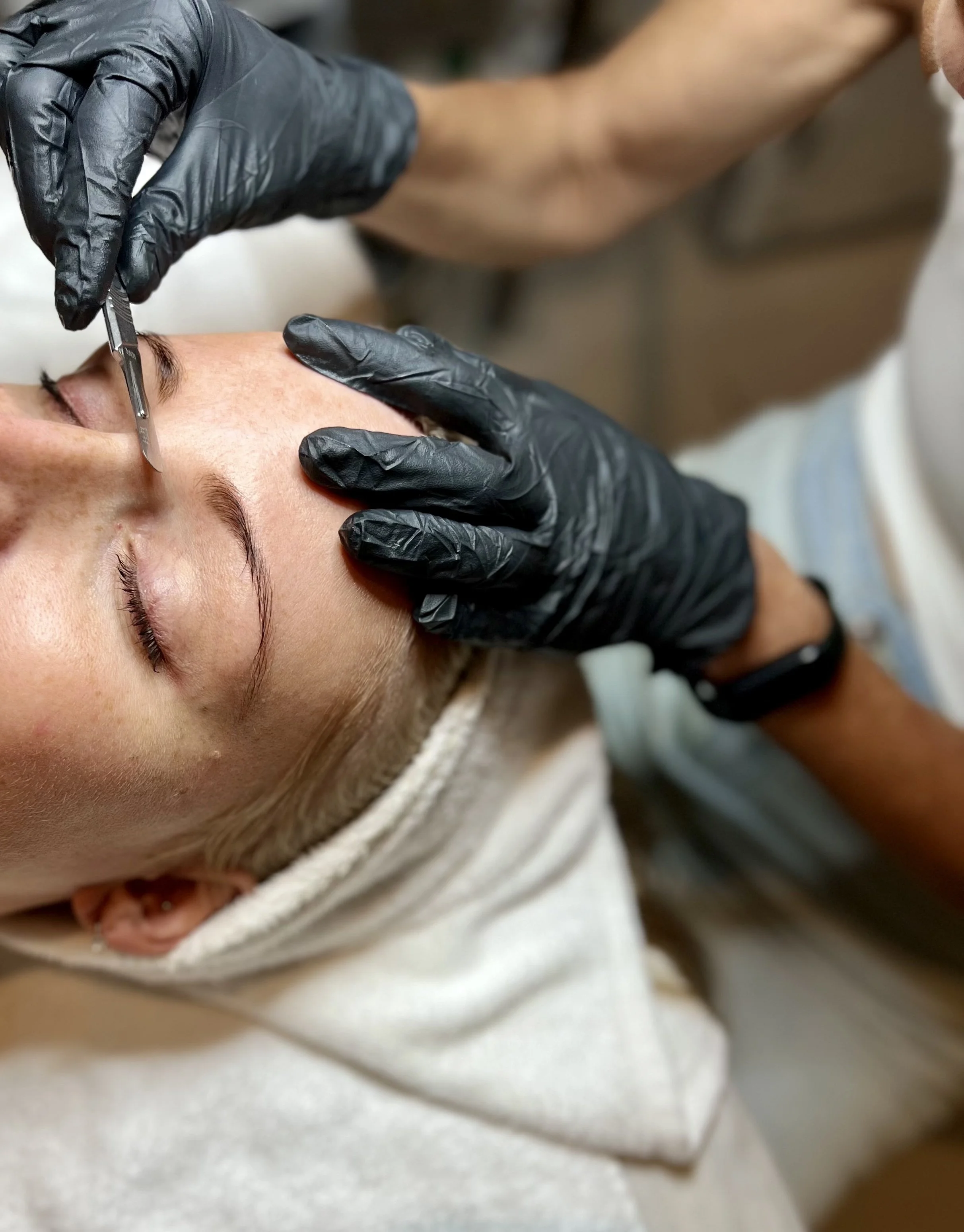 DERMAPLANING:  How to get carded.