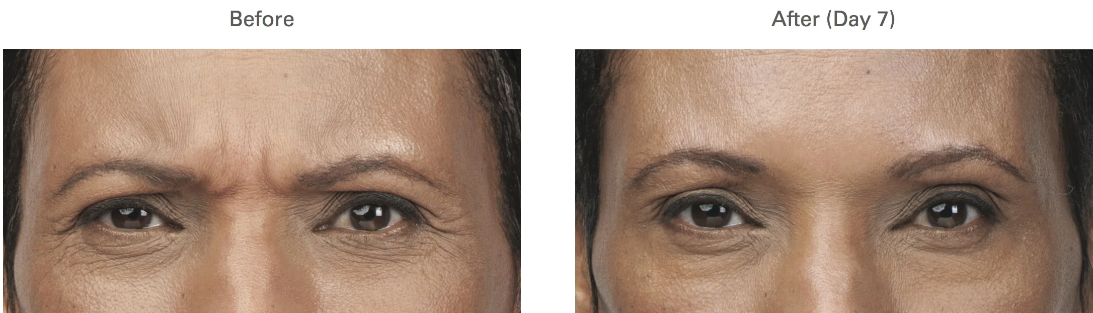 melba - brow.jpg
