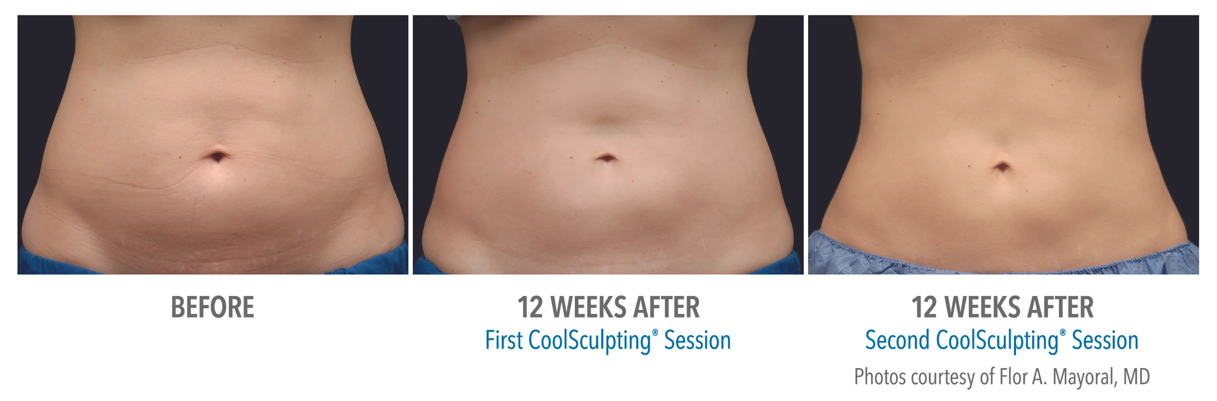 B&A-Mayoral-AB-3Set-24wk-HiRes.jpg