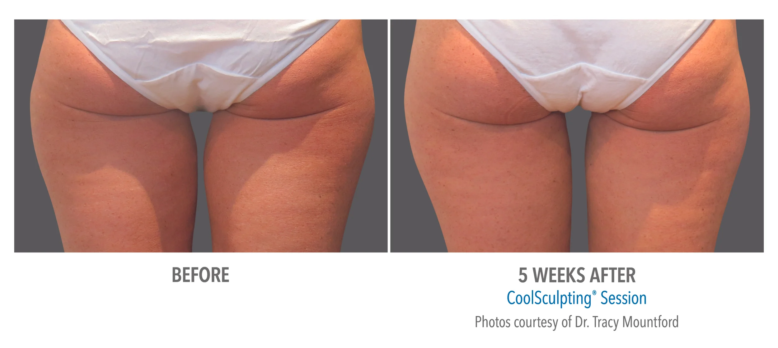 B&A-Mountford-INTH-p04-2Set-5wk-Back-HiRes.jpg