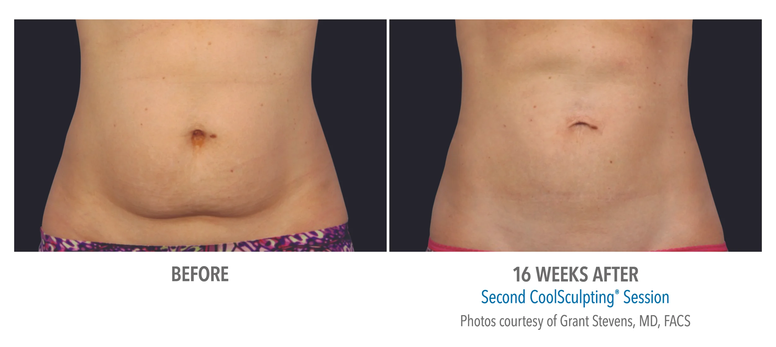 B&A-Stevens-AB-2Set-16wk-HiRes.jpg