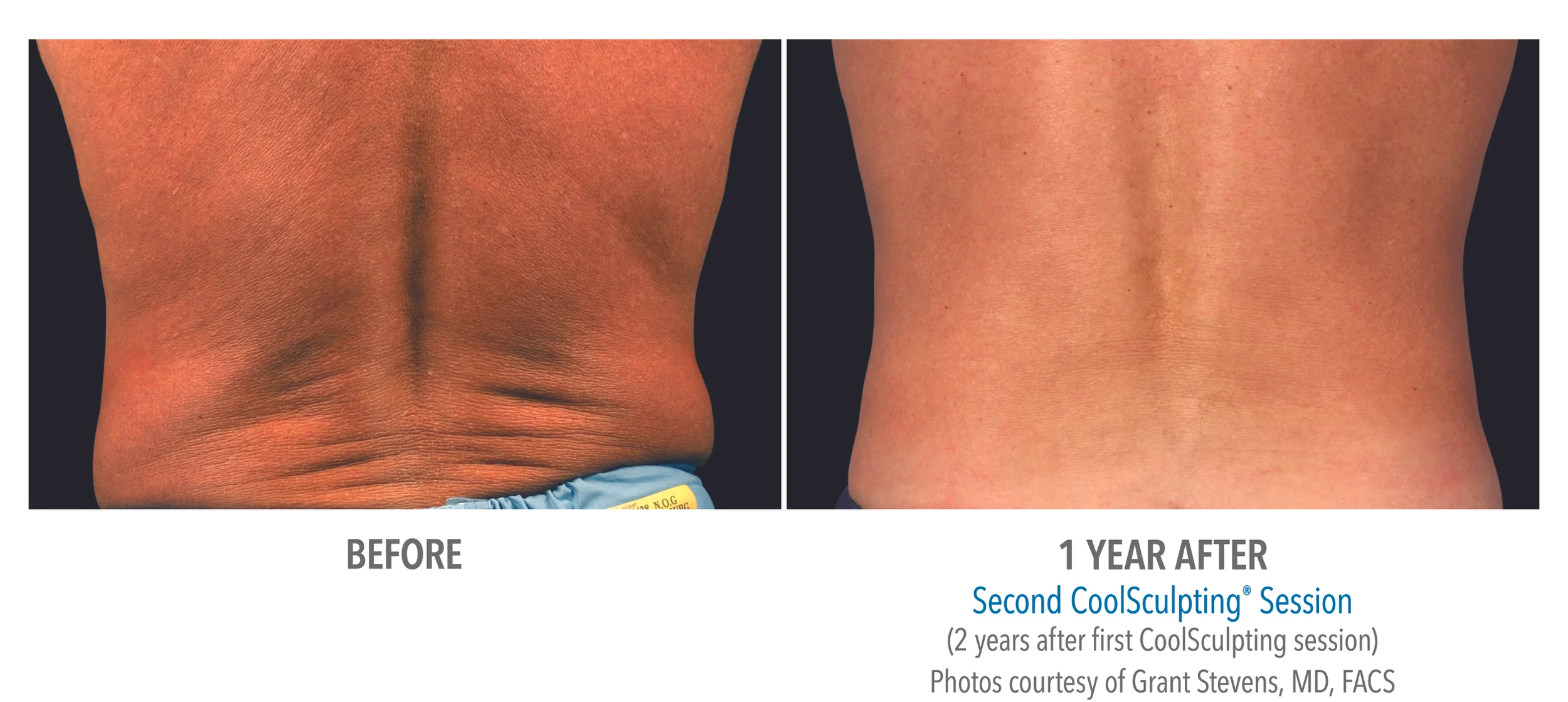 B&A-Stevens-FL-2Set-1yr-Back-HiRes.jpg