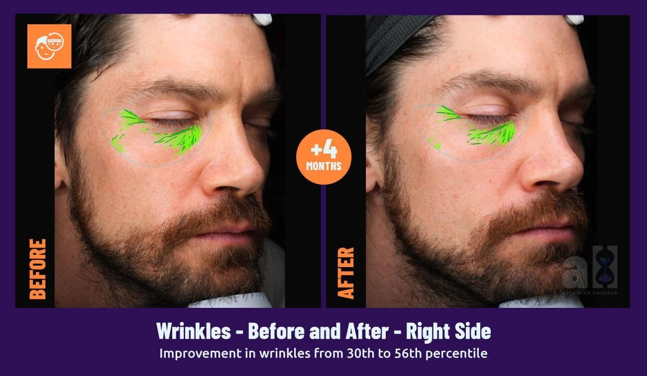 Young Goose Skincare review right side wrinkles Nick's face scans after 4 months of use - there is an improvement from 30th to 56th percentile