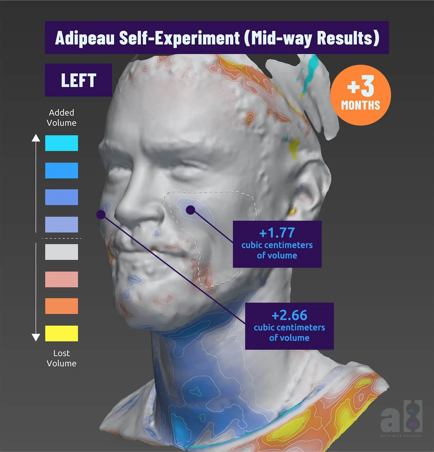 Adipeau before and after image - left side on volume improvement