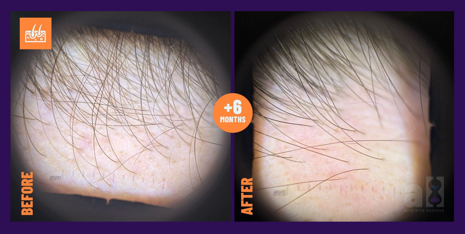 Oneskin hair serum reviews microscopic view zoomed in on left side to see improvements after 6 months of consistent use