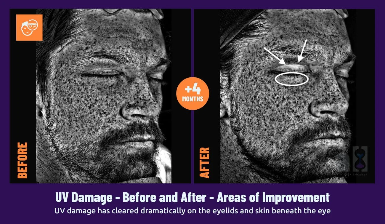 Young Goose Review Right Side UV Damage Face Scan areas of improvement after 4 months of continuous skincare use