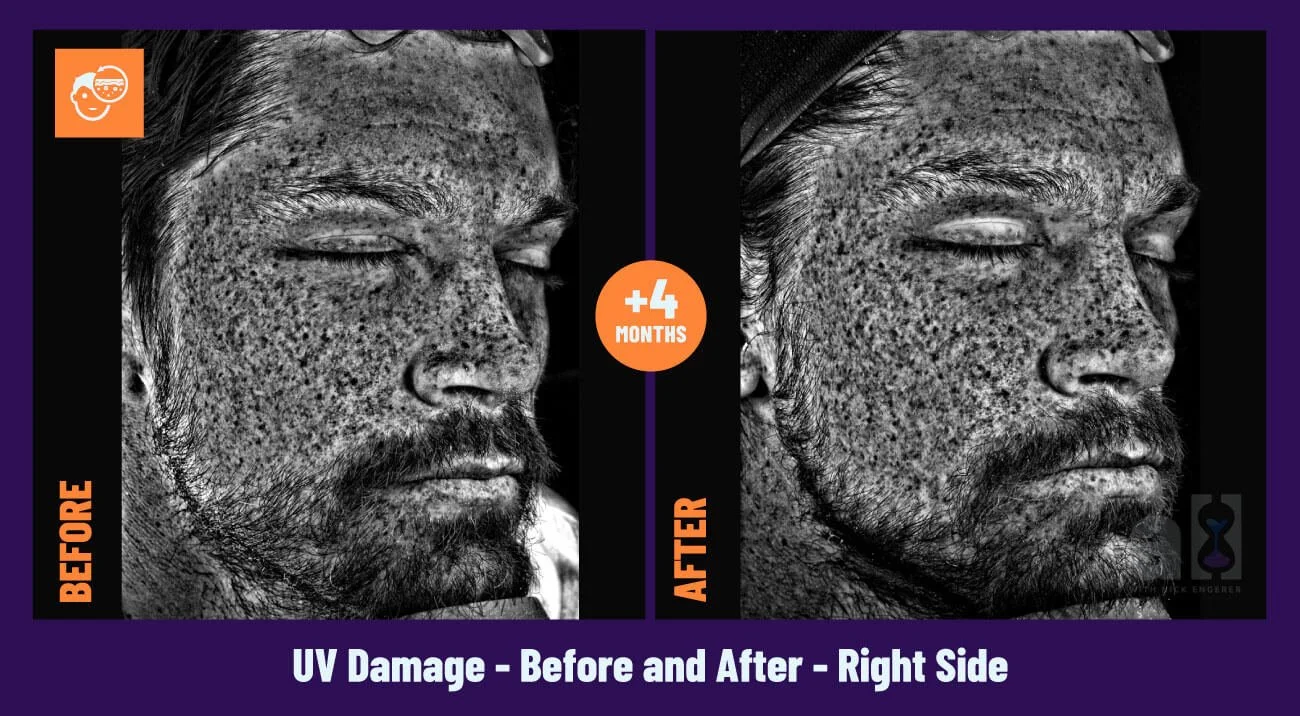 Young Goose Review Right Side UV Damage Nick's full Face Scan