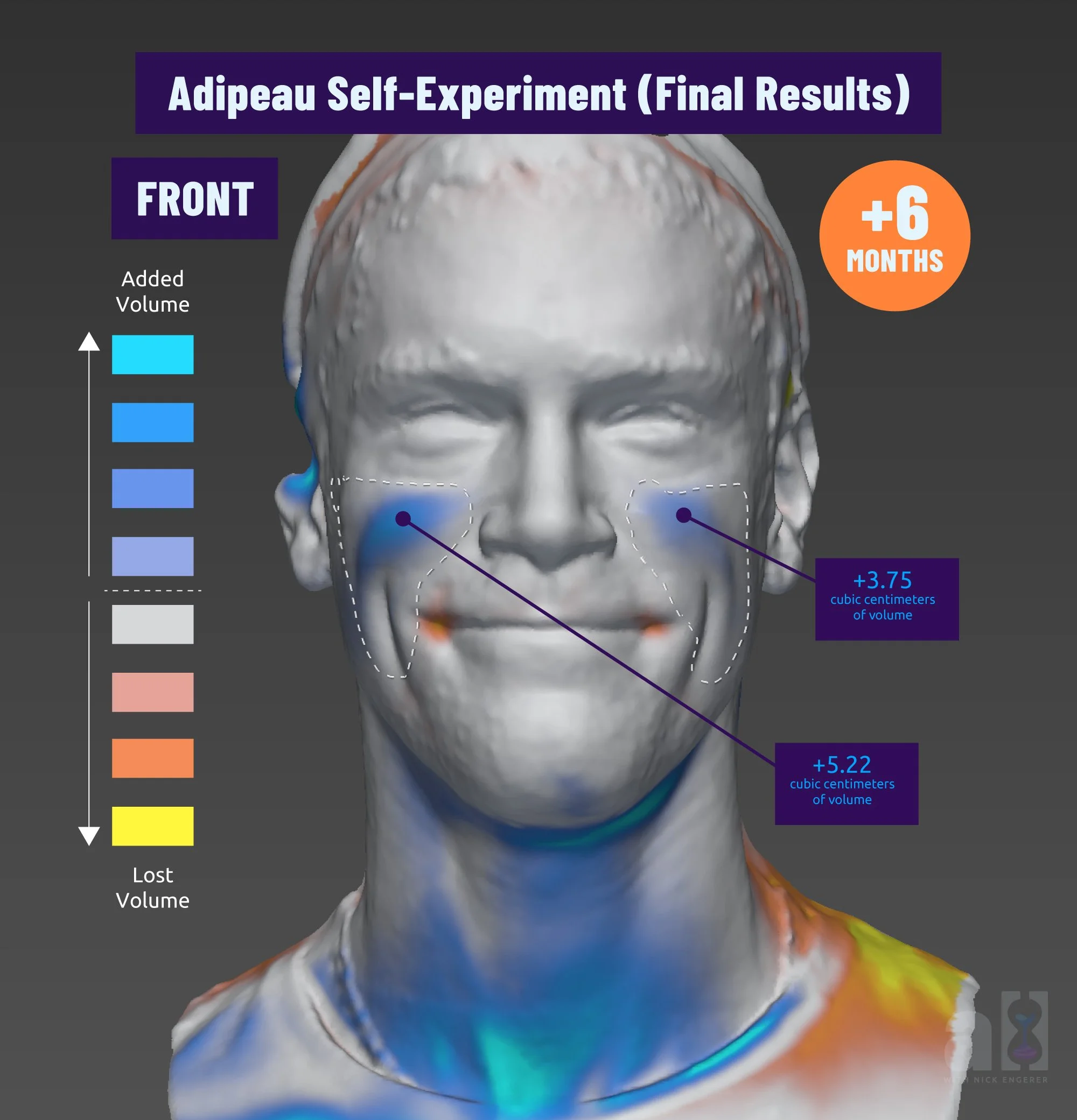 Adipeau Review Full Results Before and After Volume Scan