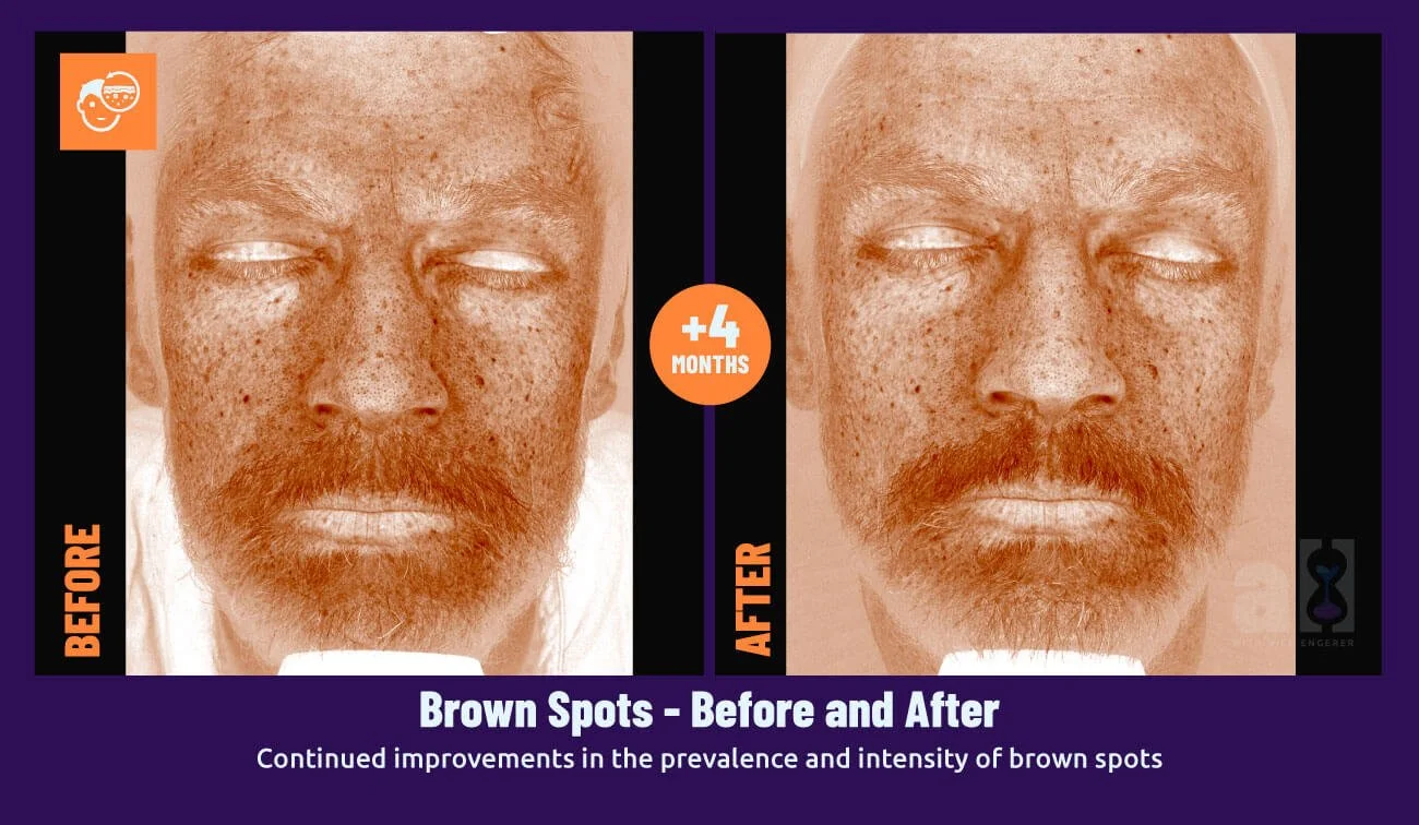 Young Goose Skincare review brown spots face scan - improvement results over 4 months of use