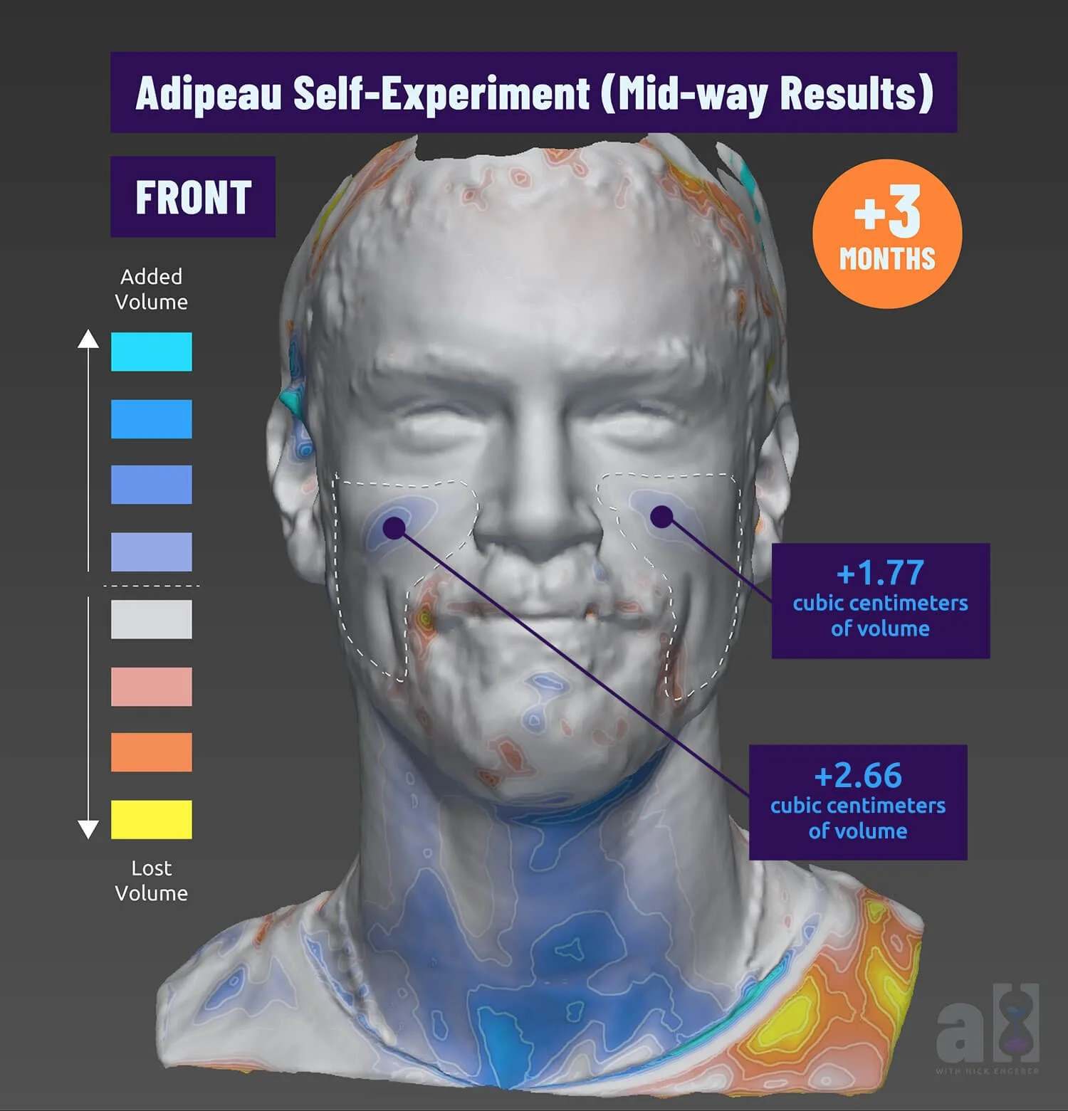 Adipeau before and after Vectra volume imaging after 3 + months of Adipeau skincare use
