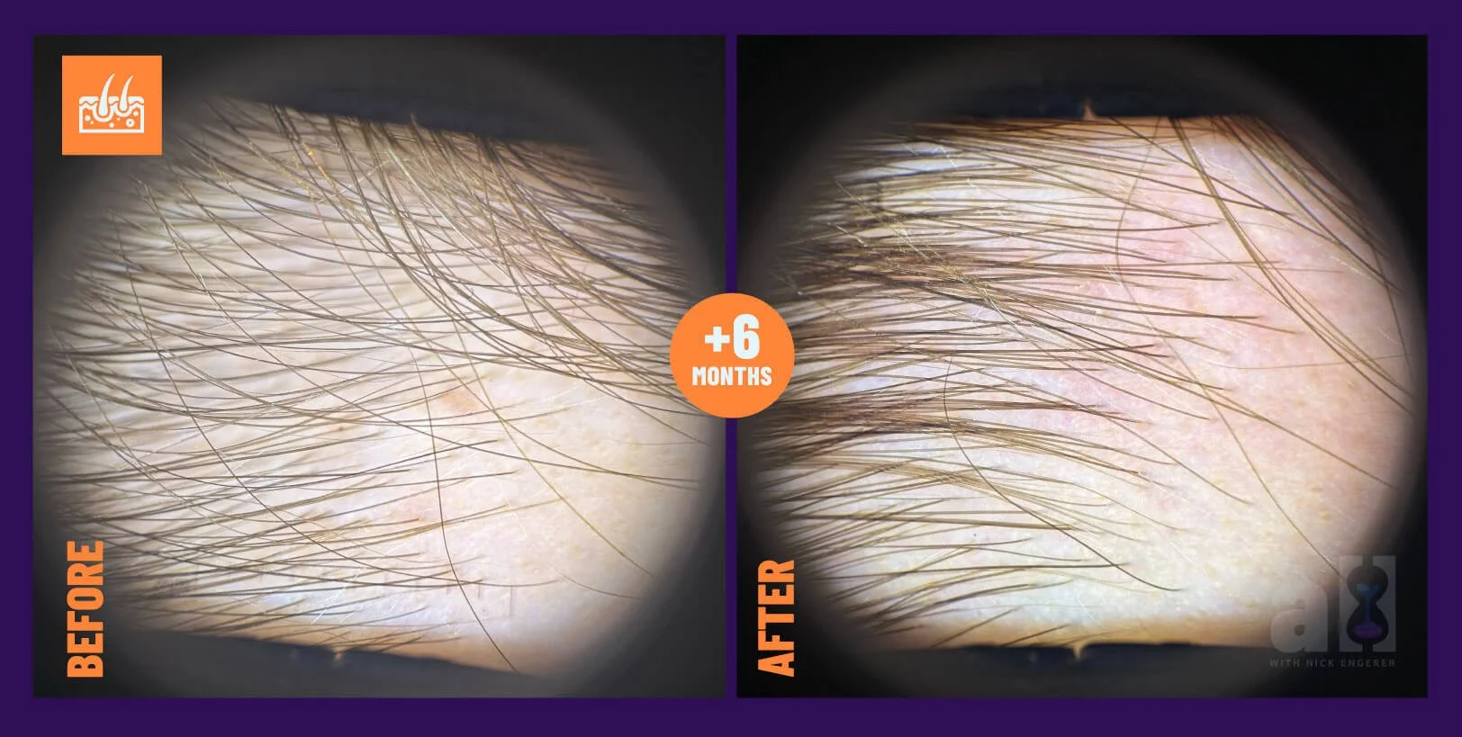 Oneskin hair serum review of right size zoomed in to see improvements after 6 months of use - microscopic view