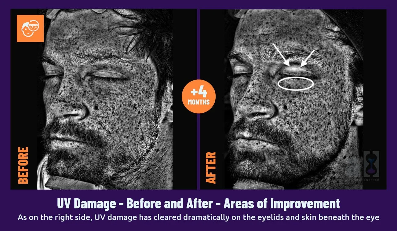 Young Goose Review Left Side UV Damage Face Scan areas of improvement highlighted for viewers