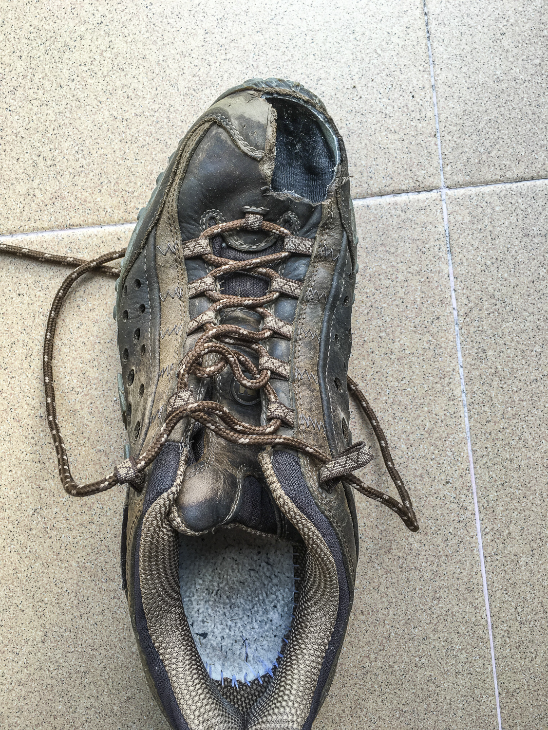 The only shoe I can now wear on my left foot