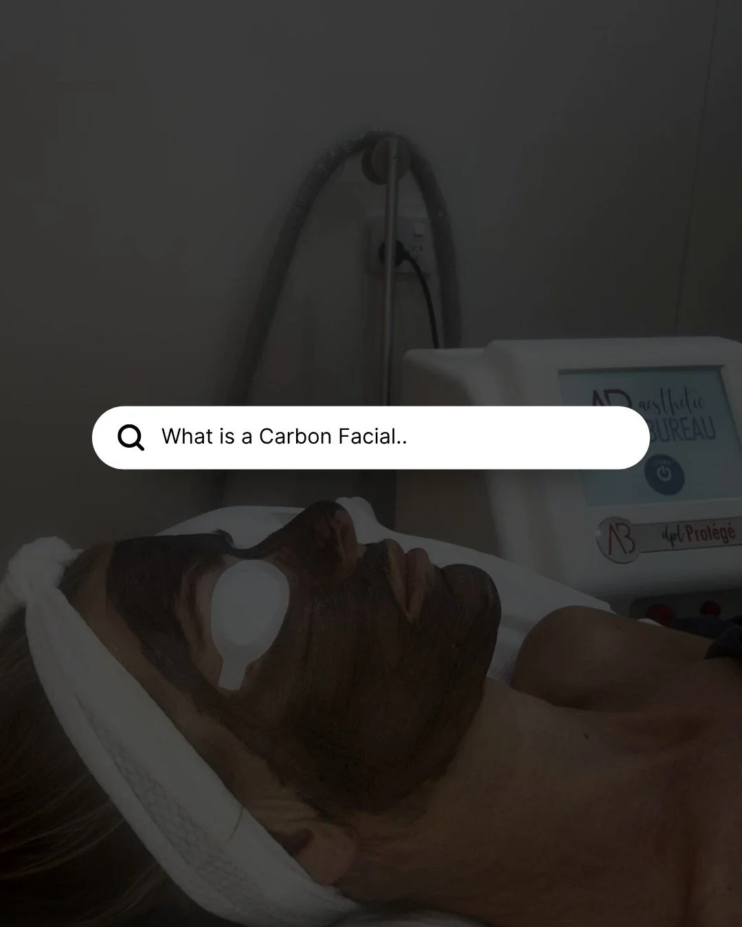 What Is a Carbon Laser Facial?

Ever wondered what the Carbon Laser Facial actually does? 💭
A carbon mask is applied to the skin to absorb oil, debris, and dead cells.
The laser then vaporises the carbon, gently exfoliating and purifying your pores 