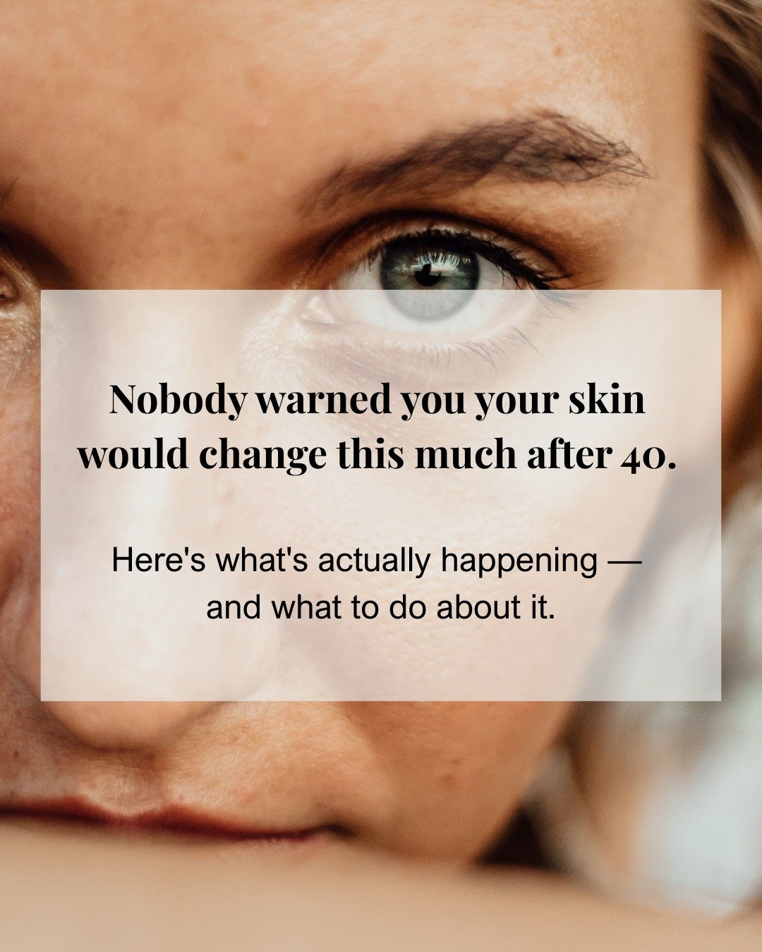 Nobody warned you your skin would change this much after 40.
The products that worked for years suddenly feel wrong. Your skin is drier, slower to bounce back, and doing things it never did before - and most advice online is written for a 25-year-old