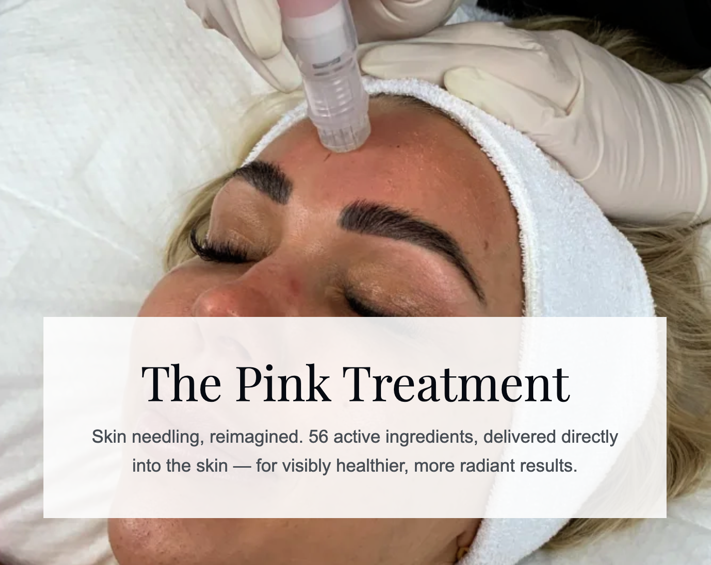 What Is The Pink Treatment? Skin Needling, Reimagined