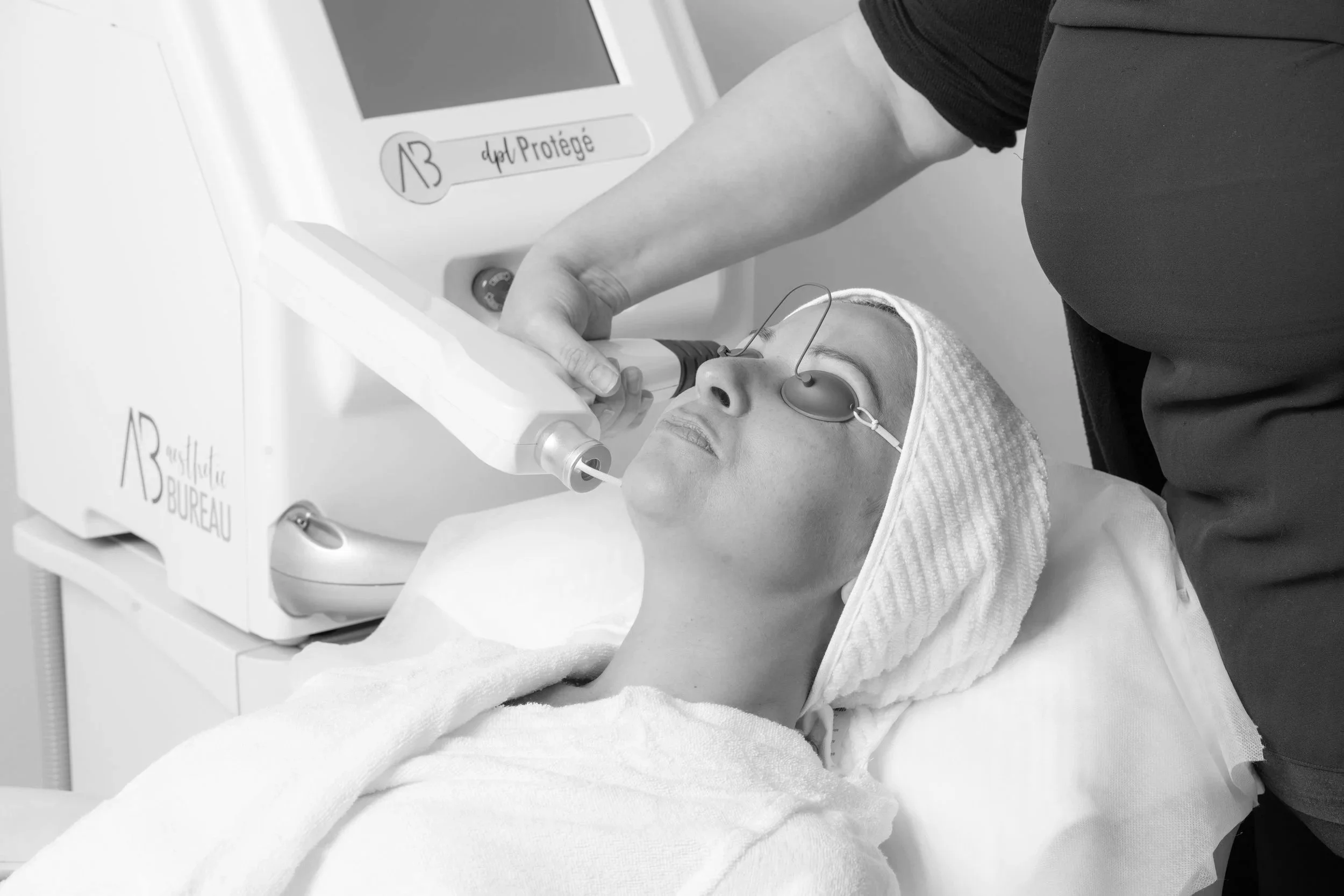 q-switch laser held at ladies face