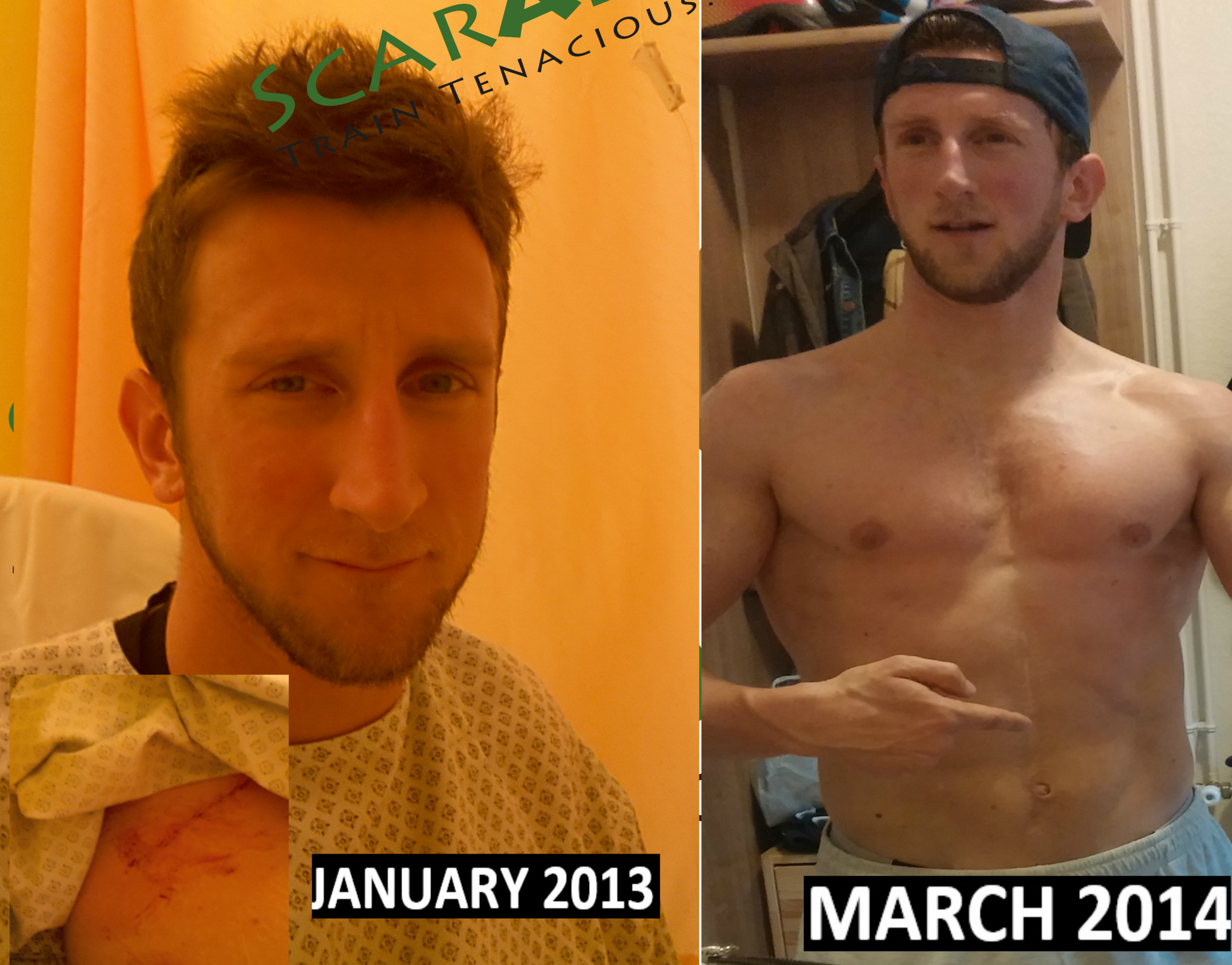 Different dates...different look at my scars!!
