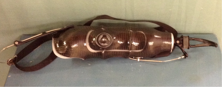 Rubin UE prosthesis.jpg