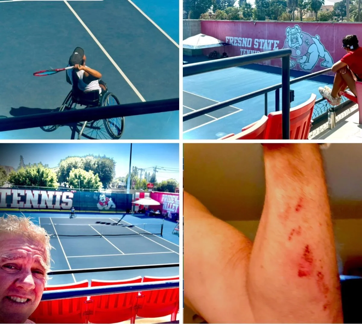 Been a gift to support our future wheelchair tennis star, Kylie. Thank you coach Pang, Fresno State Tennis and Valley Children&rsquo;s Hospital adaptive sports. Even in 100 degrees it&rsquo;s awesome seeing the progress. The goals are big. The road i