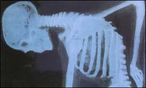 _38701815_skeleton300.jpg