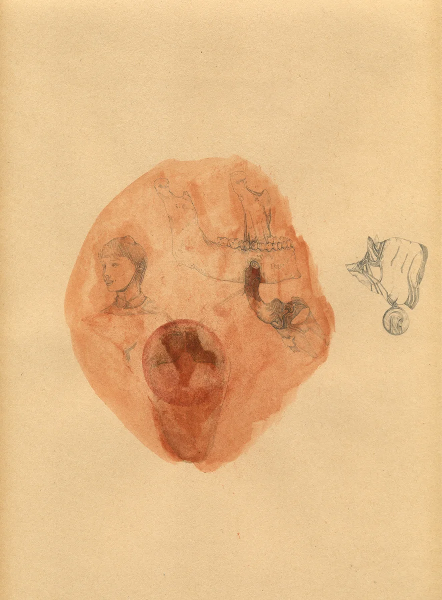 MDV_ECHEC_ANTOINE_COCHON.jpg