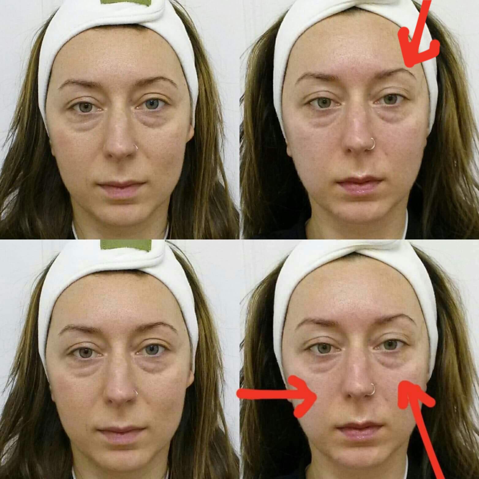 INTRODUCING THE FACELIFT FACIAL