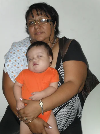 Leonardo, before his first surgery, held by his aunt, with whom the family lives. 