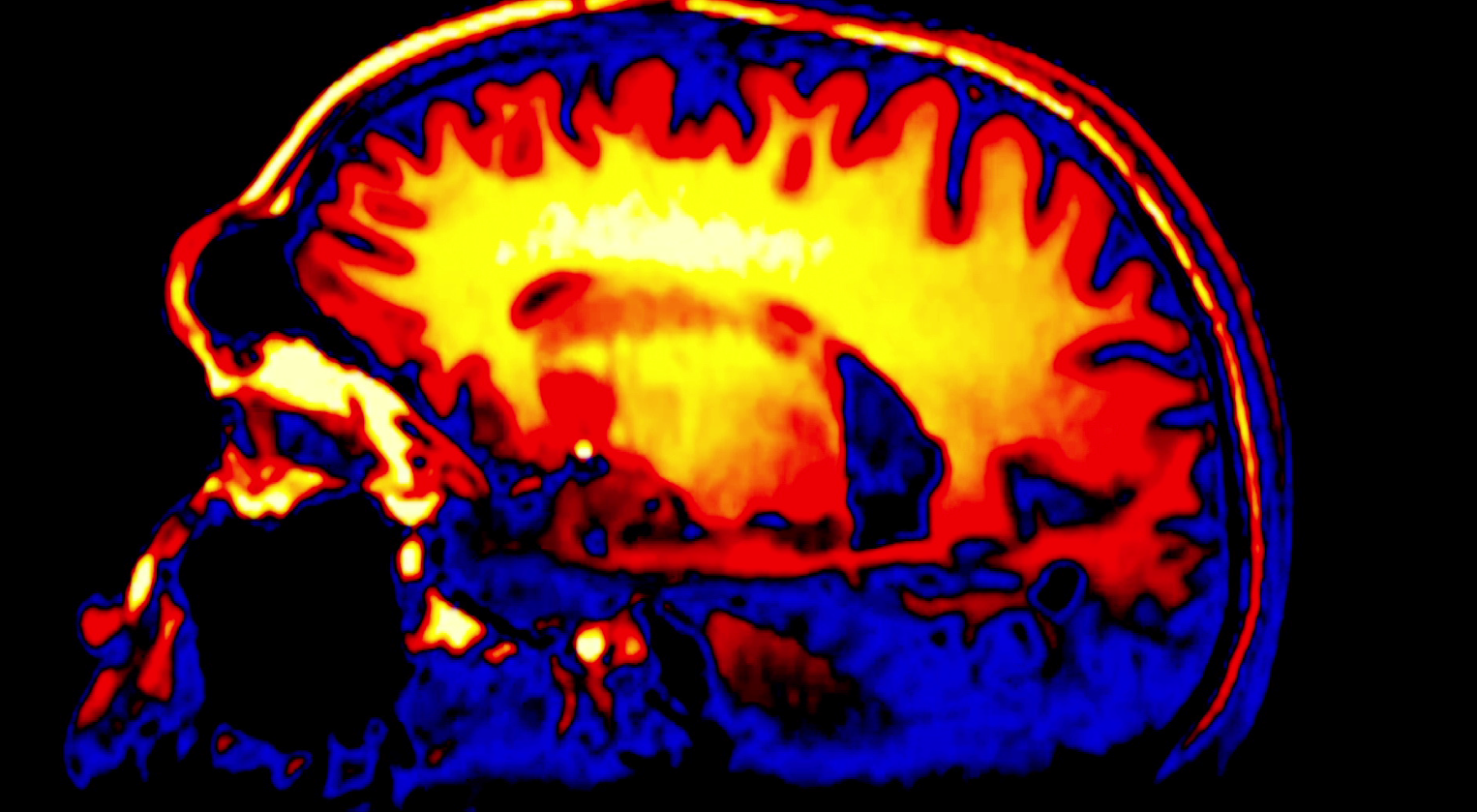Science Closes In On the Mysteries of Music