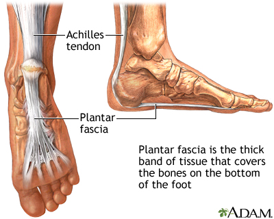 heel pain achilles tendon and plantar fasciitis