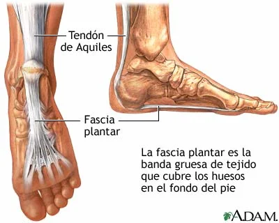 What can Rolfing® do for heel pain and Plantar Fasciitis?