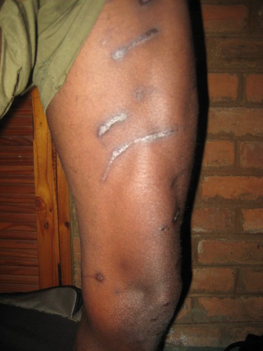 We met many diamond panners who showed us scars from beatings and dog attacks. They were all too scared to talk on camera, so we filmed them anonymously, meeting them in safe-houses and secret locations across the country.