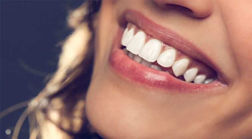 teeth-whitening.jpg