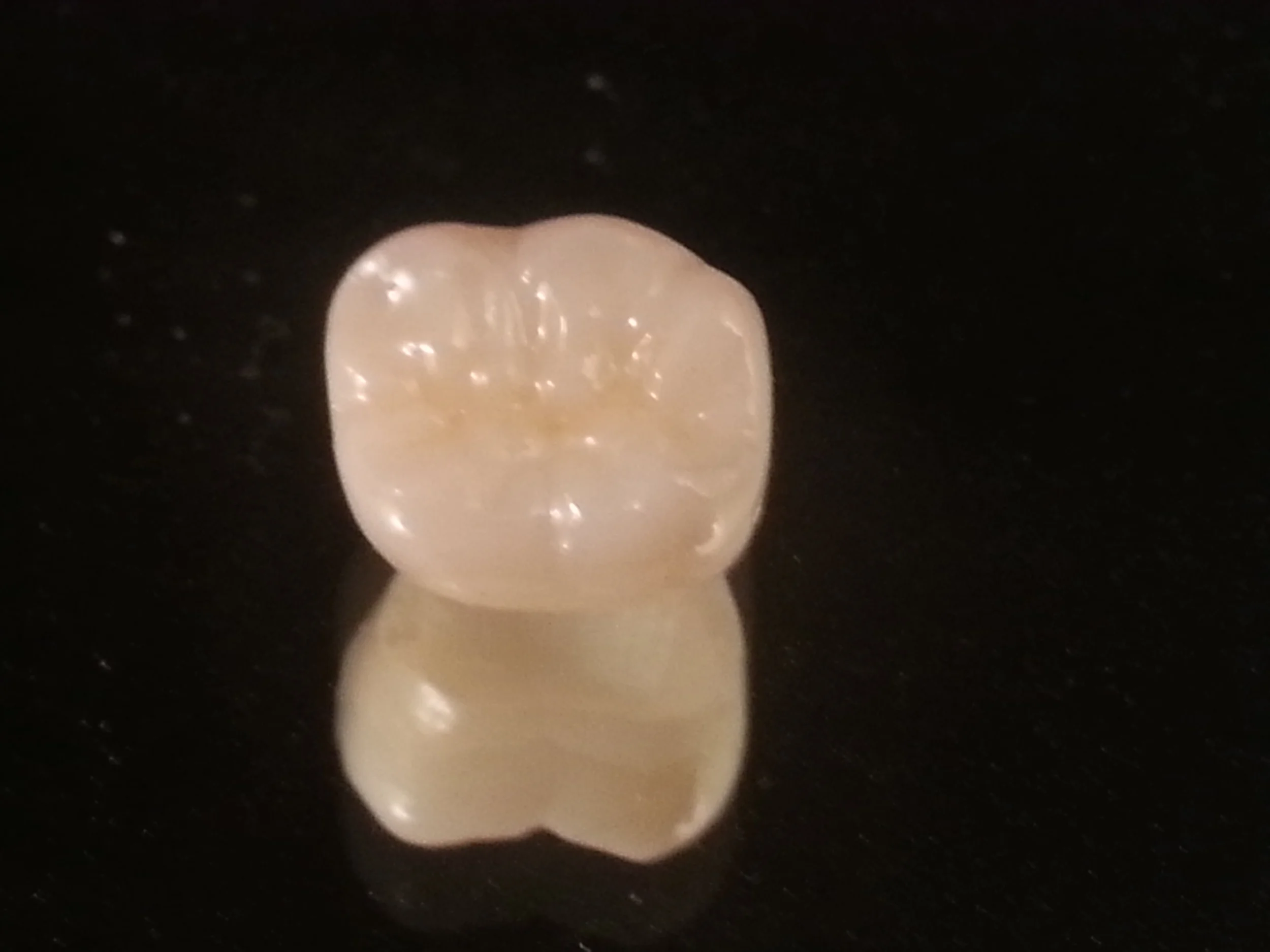 Multi Layered Zirconia old Rutherford Dental Lab