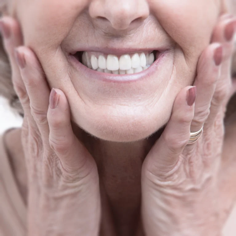 all-on-4 dental implants Perth