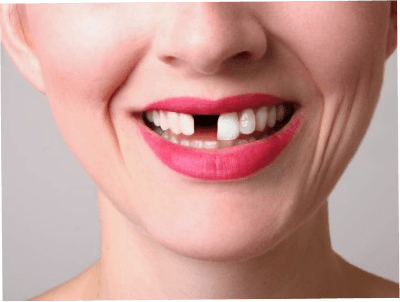 ToothPhoto.png