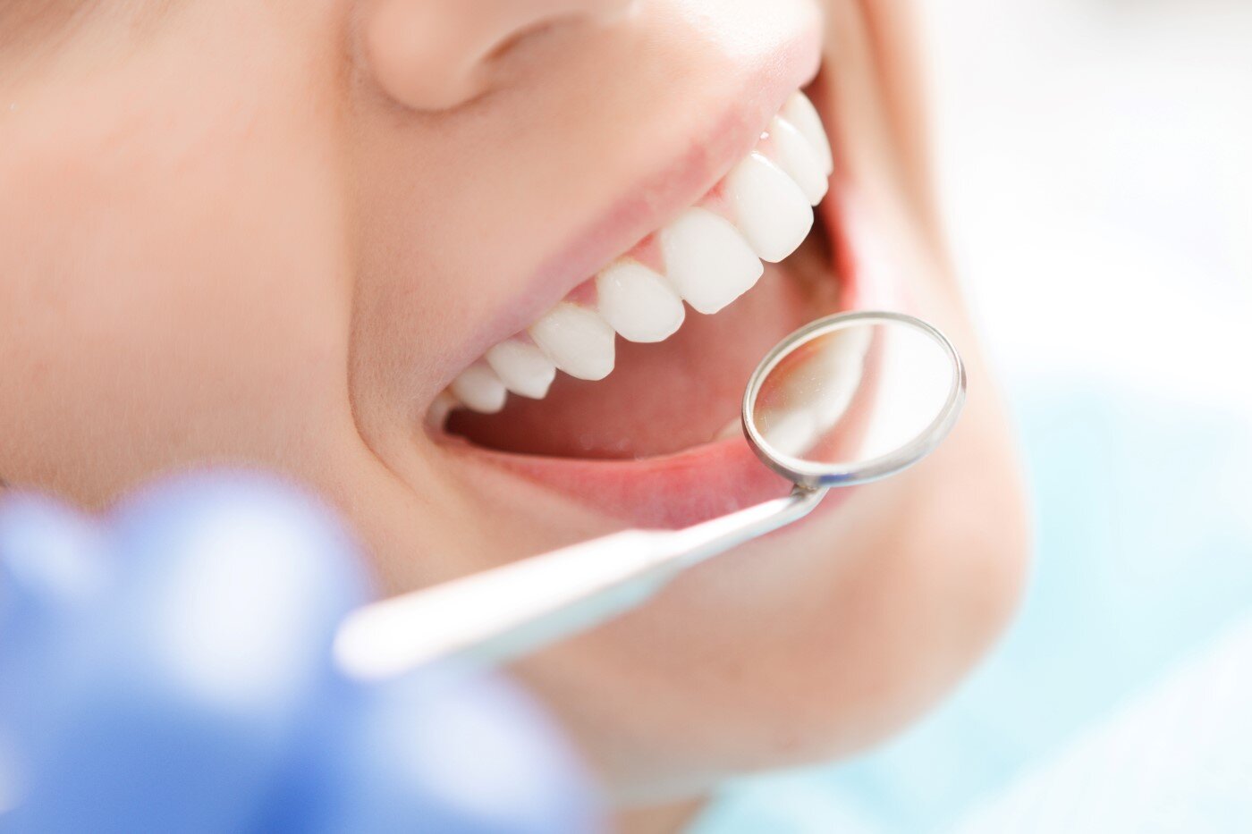 Teeth Whitening Perth | Brighten Your Smile | Cambridge City Dental