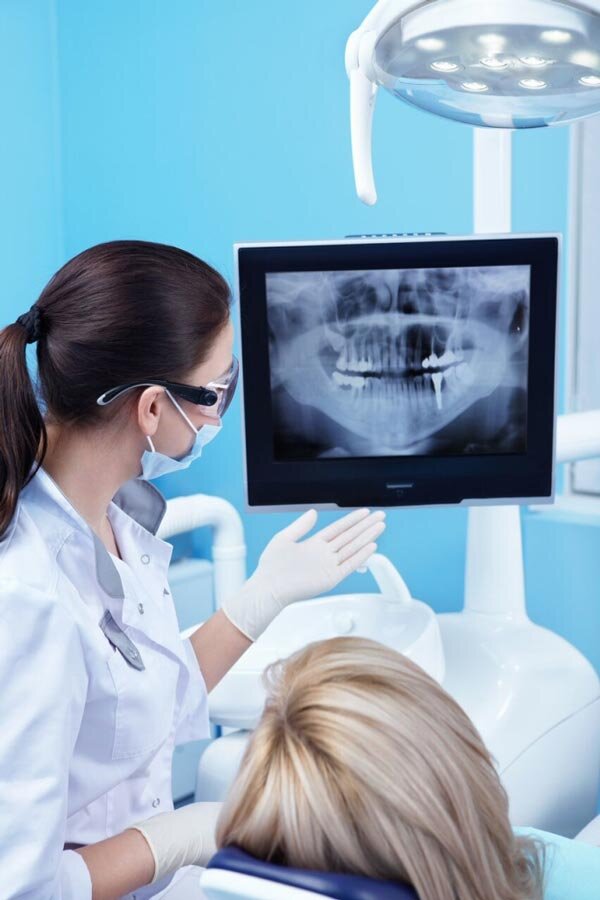 Teeth Veneers Woden