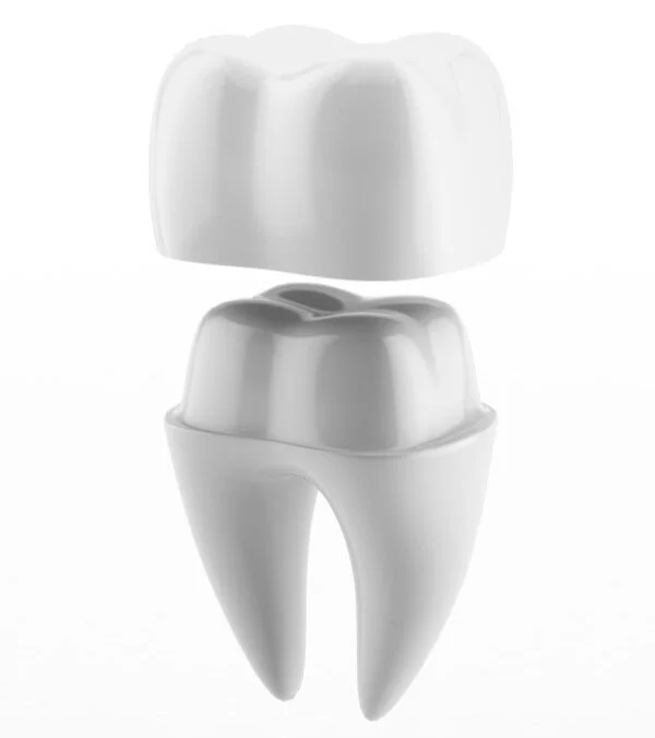 Crown Dental Perth CEREC Technology Cambridge City Dental • Perth