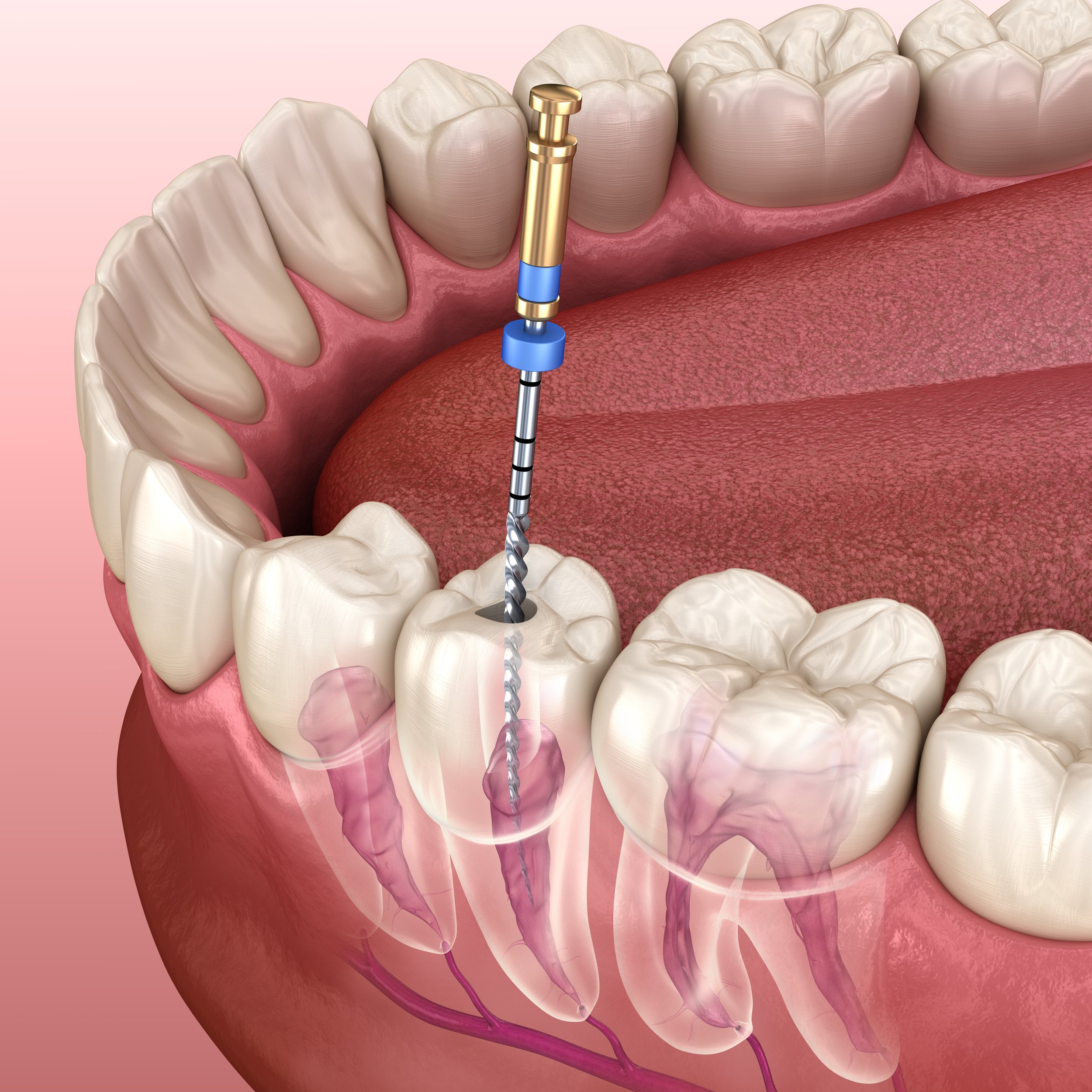 Surrey Hills Dentist