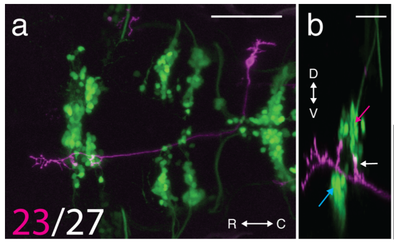 a) A single neuron that projects to extraocular motoneurons that move the eyes downward. Image is a top-down view of a larval zebrafish; magenta labels a single neuron. Green clumps of circles are motoneurons in the cranial nuclei. b) Side view of the same neuron; Magenta arrow points to neurons that move the eyes downward, blue to neurons that move the eyes upward, and white points to the prominent projection to eyes-down motoneurons. 