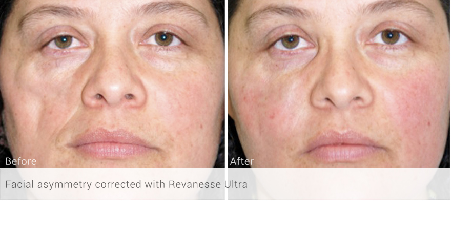 before-after_041.jpg