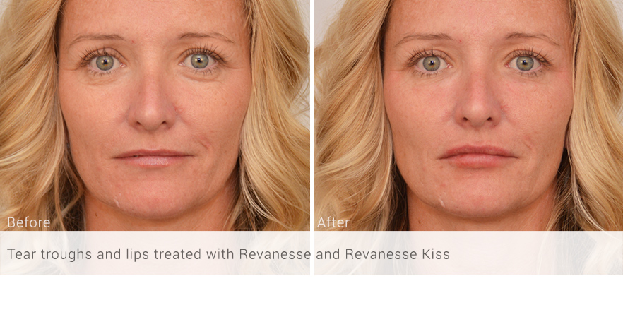 before-after_081.jpg