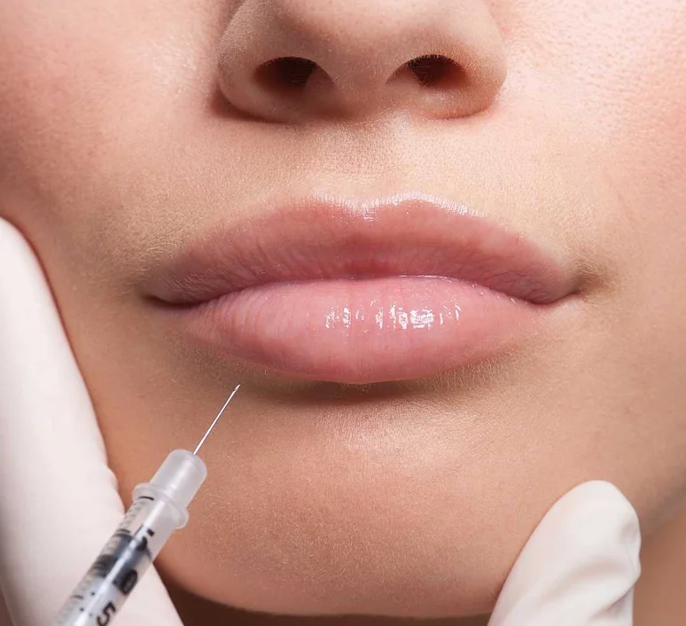 lipfillers.jpg