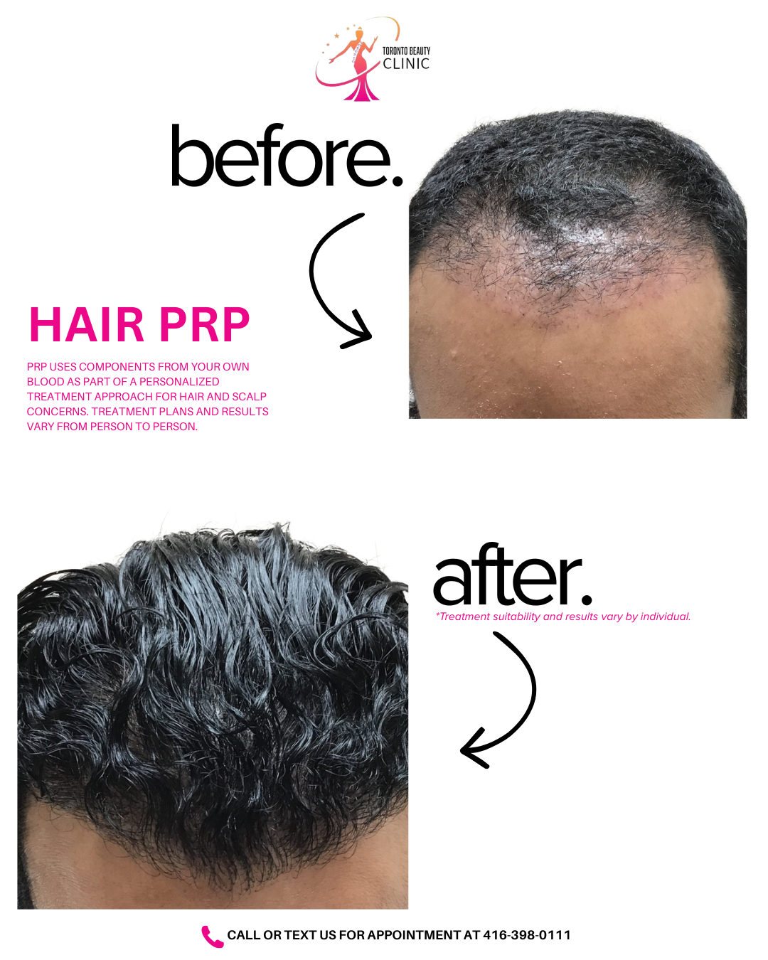 hair prp 4.png