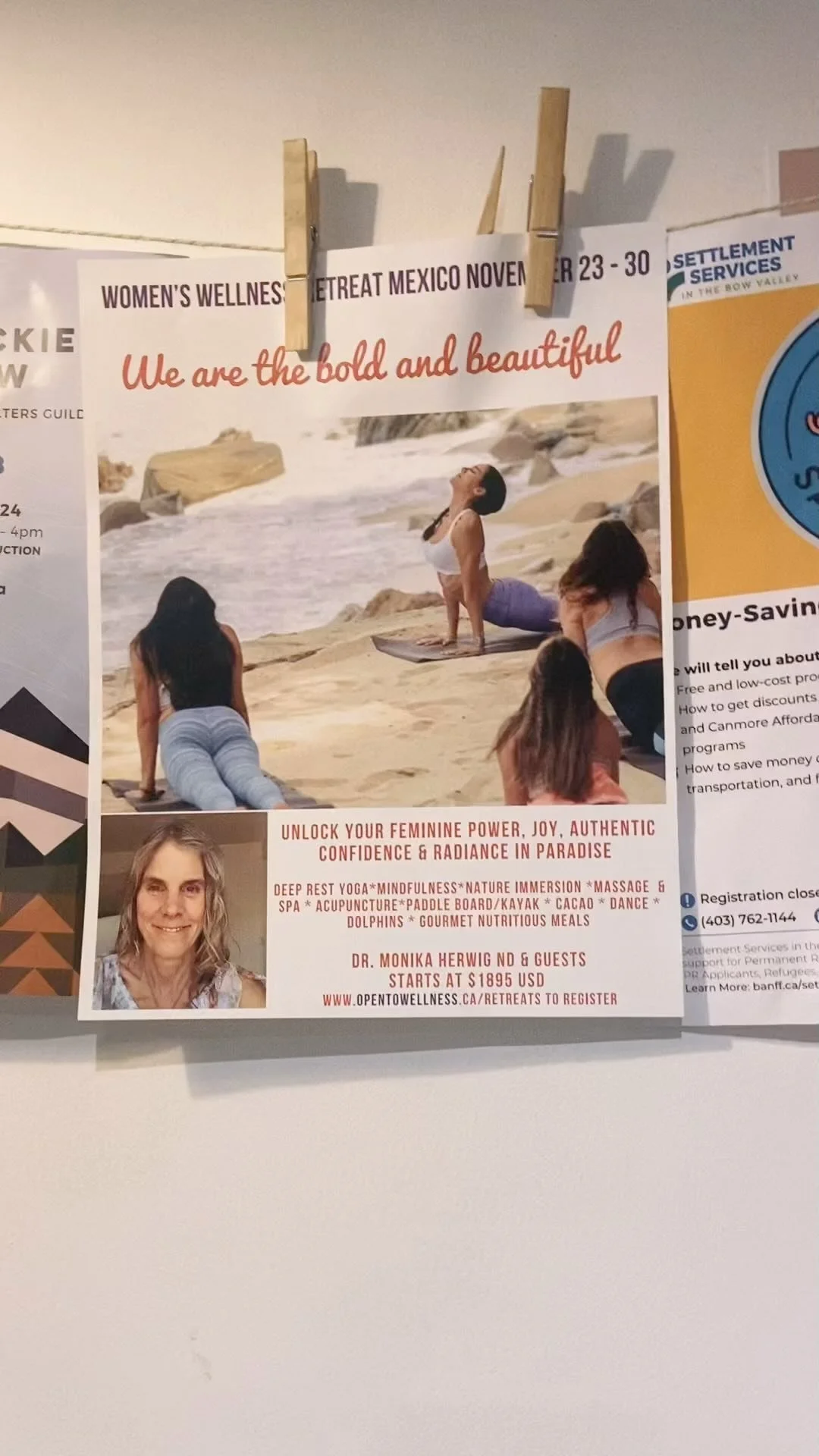 Understanding Perimenopause The Role of Estrogen, Dopamine, and